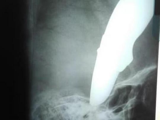 Рентгеновский снимок головы Шона Уэйна