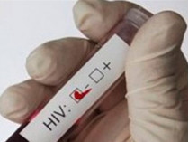 тест на ВИЧ