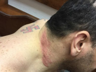 В сети показали, как экс-командир "Торнадо" Онищенко избивает себя в камере сапогом