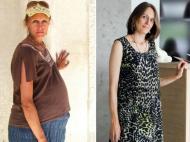 «Появилось ощущение легкости»: в Киеве женщине удалили опухоль весом 31 килограмм