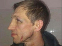 избитый в Киеве учитель физкультуры 