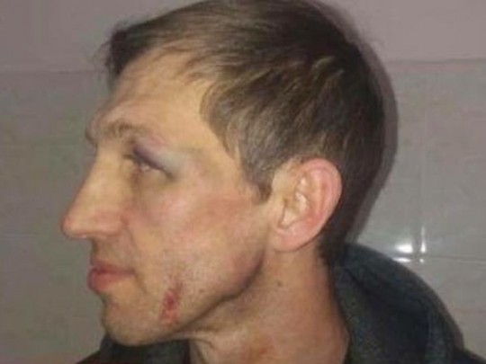 избитый в Киеве учитель физкультуры 