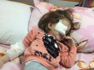 Могла остаться инвалидом: в детсаду Днепра ребенку прокололи глаз карандашом