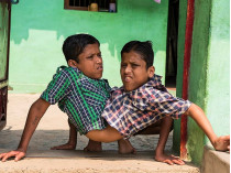 Мальчики Шиванат и Шиврам Саху научились ходить и ухаживать за собой 