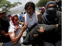 Раненый протестующий в Каракасе