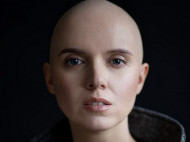 Потеряла волосы и несколько органов: Янина Соколова рассказала, как поборола рак