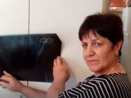 Терпела адские боли: россиянка 23 года прожила с ножницами в животе
