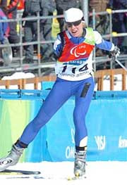 Юлия батенкова, завоевавшая на паралимпиаде в турине пять медалей: «никак не могла поверить, что у меня больше нет руки. Казалось, что она там, под бинтамий»