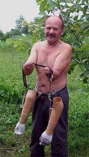 «труднее всего было научиться чистить картошку»,- говорит 63-летний павел любарский,20 лет назад оставшийся без рук и без ног