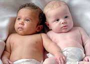 В этом году в великобритании и австралии родились две «черно-белые» пары близнецов