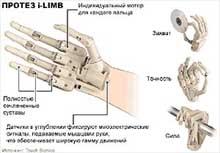 Шотландские специалисты сконструировали протез руки, в котором все пальцы двигаются и сжимаются