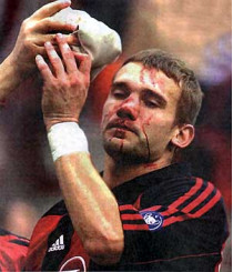 Серьезную травму андрею шевченко, из-за которой он не сыграет за сборную украины с албанцами, нанес, как и в 2001 году, футболист «болоньи» при судействе того же арбитра!
