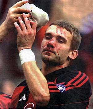Серьезную травму андрею шевченко, из-за которой он не сыграет за сборную украины с албанцами, нанес, как и в 2001 году, футболист «болоньи» при судействе того же арбитра!
