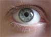 Американцы создали так называемый бионический глаз, который позволит видеть слепым людям