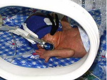 Волынские медики выхаживают девочку, которая при рождении весила&#133; 650 граммов