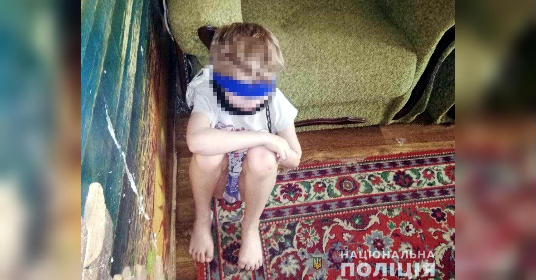 8-летнего ребенка посадили на цепь за то, что громко разговаривал:  шокирующее ЧП в Днепре (фото) - «ФАКТЫ»