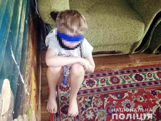 8-летнего ребенка посадили на цепь за то, что громко разговаривал: шокирующее ЧП в Днепре (фото)