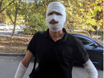Не поделили сына: в Одессе мужчина с кувалдой и ружьем напал на общественников и журналистов (фото)