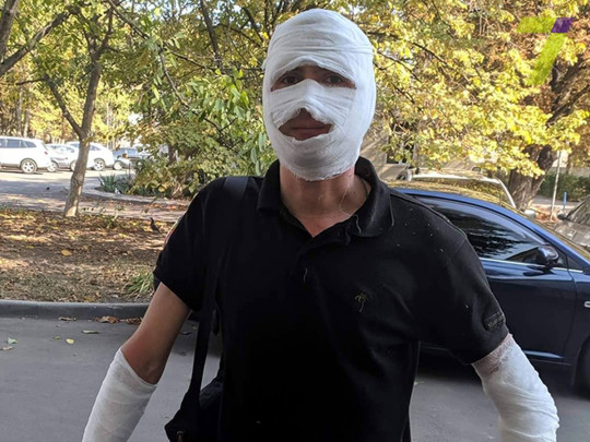 Не поделили сына: в Одессе мужчина с кувалдой и ружьем напал на общественников и журналистов (фото)