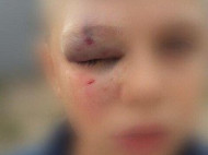 В Кривом Роге мужчина зверски избил школьника, с которым поссорился его сын (фото)