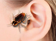 Чудесное избавление: врачи вытащили из уха женщины огромного таракана
