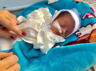 «Сын родился с опухолью на копчике, которая весила 2,5 килограмма — больше, чем сам ребенок»