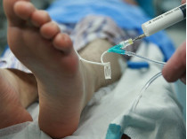 Пациент на операционном столе под анестезией