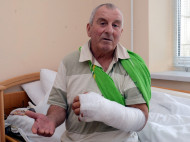 «Я сам поднял с земли отрезанную циркуляркой руку»: киевские хирурги спасли конечность пациенту