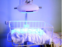 «МИРОПЛАСТ» обеспечил больницу оборудованием для лечения физиологической желтухи новорожденных