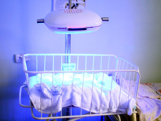 «МИРОПЛАСТ» обеспечил больницу оборудованием для лечения физиологической желтухи новорожденных