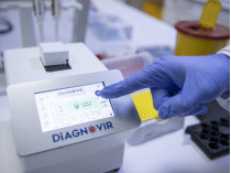 Турецкий прибор Diagnovir позволяет выявить коронавирус за 10 секунд