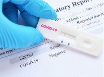 Експрес-тест на коронавірус