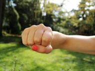 Отримала опіки стегна і&nbsp;сідниць: в&nbsp;Одесі дівчинка постраждала від дій матері