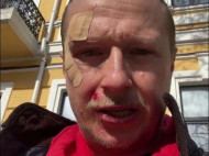 Избиение Майкла Щура: Геращенко сбросил видео, которое журналист сам предоставил полиции