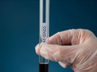 В&nbsp;Украине почти 5 тысяч новых случаев COVID-19, выздоровели 12&thinsp;845 человек