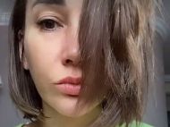 Лицо серьезно пострадало: на&nbsp;Анфису Чехову напала собака Картошка