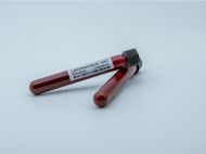 Коронавірус в&nbsp;Україні: 102 людини померли, серед антилідерів по&nbsp;захворюваності&nbsp;&mdash; Київ, Запорізька та&nbsp;Дніпропетровська області