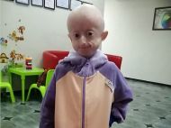 Унікальна дівчинка, за&nbsp;долею якої стежила вся Україна, померла у&nbsp;Вінниці
