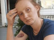 Колишній есбеушник п&rsquo;яним побив поліцейську в&nbsp;Мукачево&nbsp;&mdash; суд його виправдав