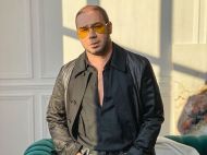 &laquo;Було дуже боляче&raquo;: Андре Тан пересадив волосся на&nbsp;голові