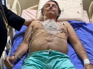 Президент Бразилії потрапив до&nbsp;лікарні після десятиденного нападу гикавки