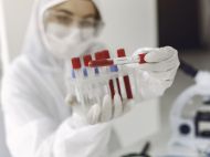 В&nbsp;Україні стрімке зростання хворих на&nbsp;коронавірус: майже 12 тисяч на&nbsp;добу