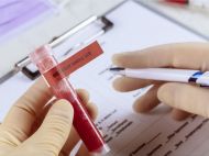 В&nbsp;Україні у&nbsp;вихідні різко зменшилася кількість COVID-інфікованих