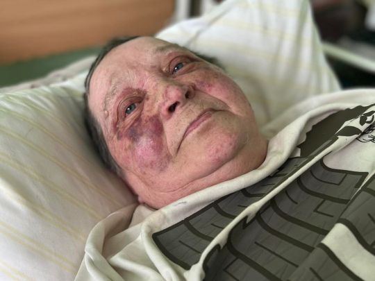 рашисти побили пенсіонерку