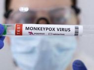 В&nbsp;Украине зафиксировали новый случай оспы обезьян