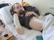 &laquo;Рашисты били меня ногами с&nbsp;криками: &laquo;С*ка, ты&nbsp;знаешь, сколько колонн наших сгорело?!&raquo;: житель Черниговщины чудом выжил в&nbsp;оккупации