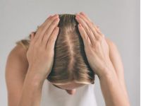 лікування випадання волосся
