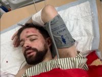У Степана Більченка&nbsp;— набряк мозку та перелом черепа. Фото зі сторінки Владислава Кононова