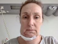 &laquo;Відчула, що&nbsp;в&nbsp;роті повно вибитих кулею зубів. Не&nbsp;зупиняючи машину, виплюнула їх&nbsp;в&nbsp;руку й&nbsp;викинула у&nbsp;вікно&raquo;: поранена жінка врятувала дітей від окупантів