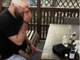 В Затоці відпочивальник побив військового, фото соцмережі